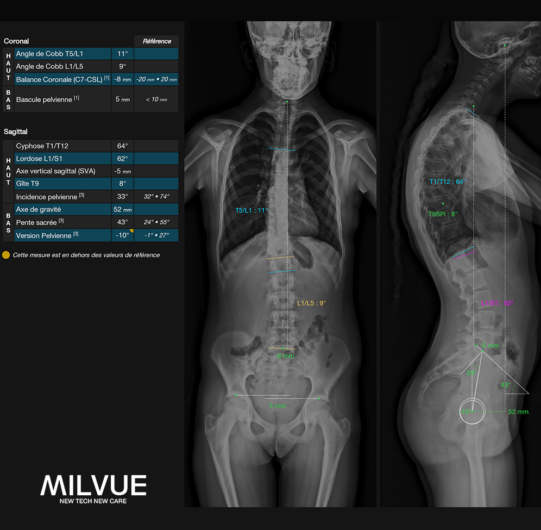 TechCare Spine