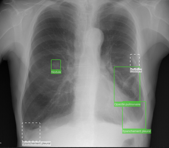 techcare chest