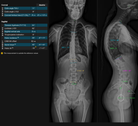 techcare spine